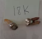 18K Gold Teeth